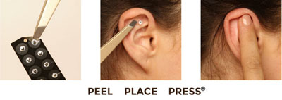 ear seed placement
